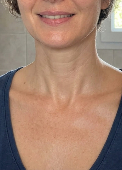 Après