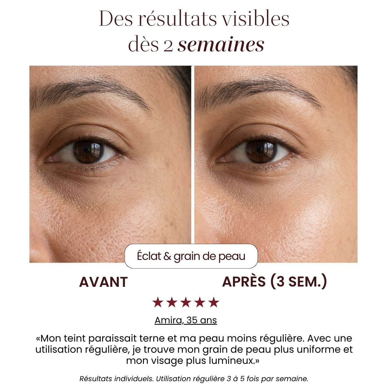 Soin LED Précision Auréa™