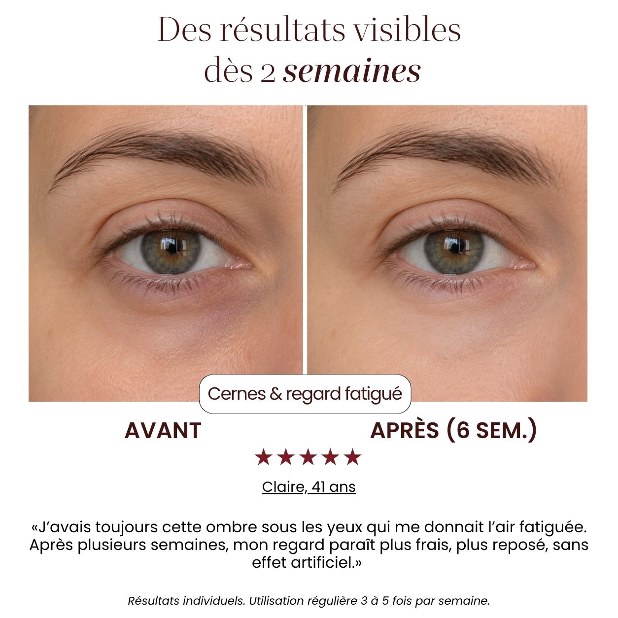 Soin LED Précision Auréa™
